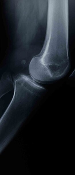 Maestría en FISIOTERAPIA TRAUMATOLÓGICA